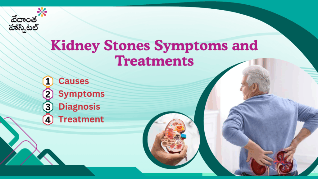 Kidney Stones Symptoms and Treatments