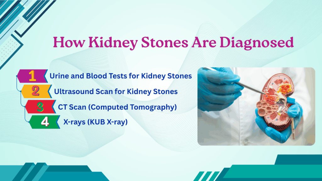 Kidney Stones Symptoms and Treatments