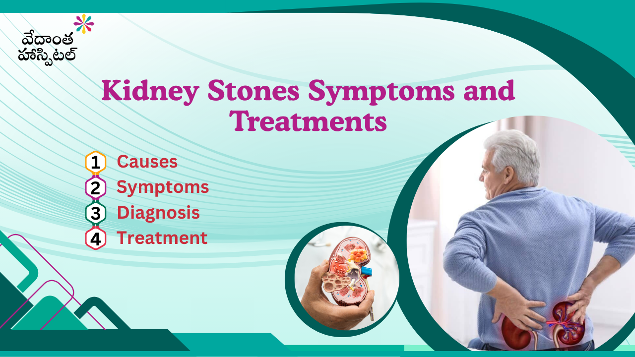 Kidney Stones Symptoms and Treatments | Causes, Diagnosis
