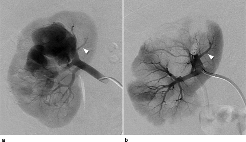 Neurosurgery Hospital in Kadapa