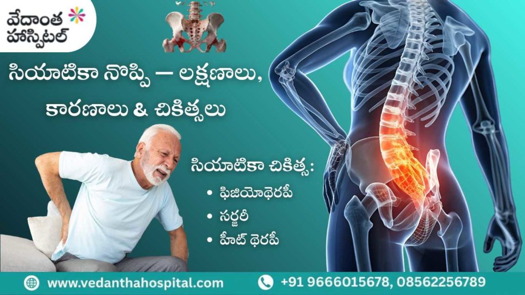 సియాటికా నొప్పి: 7 ముఖ్య లక్షణాలు