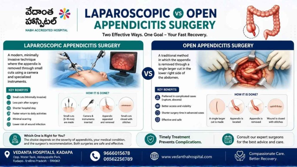 Laproscopic vs open for appendicitis surgery image